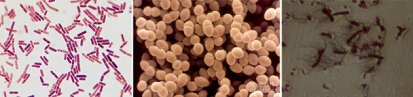 Sticks Escherichia, fekální enterococcus a pro - hlavní patogeny chronické bakteriální prostatitidy